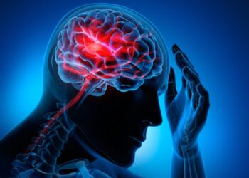 Medical illustration of a brain with stroke symptoms